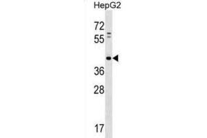 Western Blotting (WB) image for anti-Lipid Phosphate Phosphatase-Related Protein Type 5 (LPPR5) antibody (ABIN2998648)