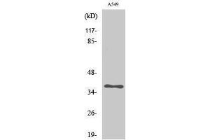 Western Blotting (WB) image for anti-Aldo-Keto Reductase Family 1, Member E2 (AKR1E2) (Internal Region) antibody (ABIN6280845)