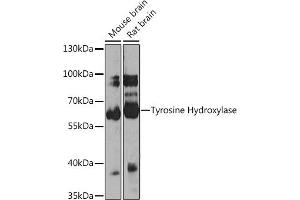 Western blot analysis of extracts of various cell lines, using Tyrosine Hydroxylase antibody (ABIN1683183, ABIN3015012, ABIN3015013 and ABIN6213590) at 1:1000 dilution. (Tyrosine Hydroxylase Antikörper)
