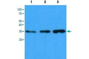 Western blot analysis of Lane 1: HeLa cell lysate, Lane 2: HepG2 cell lysate and Lane 3: 293T cell lysate with CBR1 monoclonal antibody, clone AT4E12  at 1:1000 dilution followed by HRP-conjugated goat anti-mouse secondary antibody and visualized by ECL detection system. (CBR1 Antikörper)