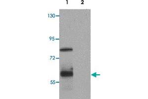 Western blot analysis of IRF4 in Jurkat cell lysate with IRF4 polyclonal antibody  at 1 ug/mL. (IRF4 Antikörper  (C-Term))