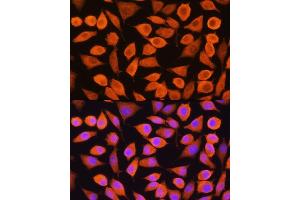 Immunofluorescence analysis of L929 cells using Cytokeratin 5 (Cytokeratin 5 (KRT5)) Rabbit pAb (ABIN3016404, ABIN3016405, ABIN3016406 and ABIN6219743) at dilution of 1:100. (Cytokeratin 5 Antikörper)