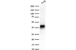 ABIN6383801 to EpCAM was successfully used to stain an approx. (EpCAM Antikörper  (Extracellular Domain))