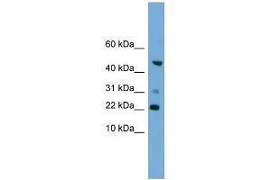 WB Suggested Anti-RAC1 Antibody Titration: 0. (RAC1 Antikörper  (Middle Region))