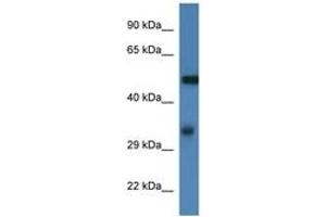 Image no. 1 for anti-Fascin (FSCN1) (AA 93-142) antibody (ABIN6746004) (Fascin Antikörper  (AA 93-142))