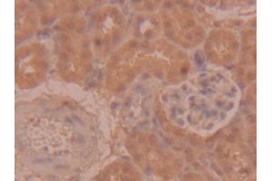 DAB staining on IHC-P; Samples: Mouse Kidney Tissue (PEDF Antikörper  (AA 125-261))
