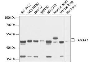 Western blot analysis of extracts of various cell lines, using  antibody (ABIN1678673, ABIN3018016, ABIN3018017 and ABIN6220336) at 1:1000 dilution. (Annexin VII Antikörper  (AA 237-466))