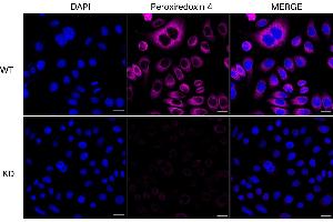 Immunocytochemical staining of HeLa cells using Peroxiredoxin 4 antibody (ABIN7799779), 1:1,000), Top panel: wild-type (WT), Bottom panal: Peroxiredoxin 4 shRNA knockdown (KD). (Rekombinanter Peroxiredoxin 4 Antikörper)