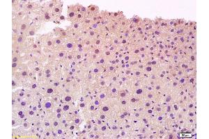 Immunohistochemistry (IHC) image for anti-Cytochrome P450, Family 27, Subfamily A, Polypeptide 1 (CYP27A1) (AA 321-420) antibody (ABIN708911)