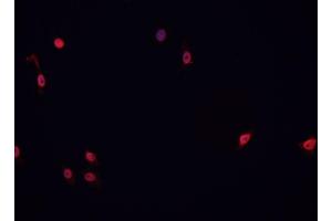 ABIN6266767 staining HeLa cells by IF/ICC. (ATRX Antikörper  (N-Term))