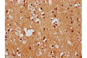 IHC image of ABIN7152731 diluted at 1:400 and staining in paraffin-embedded human brain tissue performed on a Leica BondTM system. (FEZF1 Antikörper  (AA 1-115))