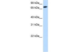 Western Blotting (WB) image for anti-Forkhead Box O1 (FOXO1) antibody (ABIN2463785) (FOXO1 Antikörper)