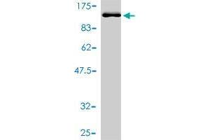 Western Blot detection against Immunogen (92. (TDP1 Antikörper  (AA 1-608))