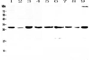 Western blot analysis of 14-3-3 sigma  using anti-14-3-3 sigma  antibody . (14-3-3 sigma/SFN Antikörper  (AA 1-248))