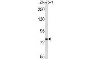 Western Blotting (WB) image for anti-Single-Minded Homolog 1 (SIM1) antibody (ABIN2997049) (SIM1 Antikörper)