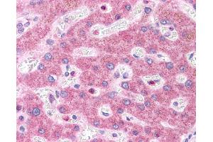 Immunohistochemistry (IHC) image for anti-HNF1 Homeobox A (HNF1A) (N-Term) antibody (ABIN2784536)