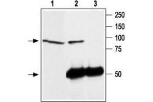 Immunoprecipitation of rat brain lysate: - 1. (TRPC4 Antikörper  (C-Term, Intracellular))