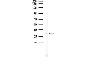 Western blot analysis of lysates from COLO205 cells(heat-shock treatment), using Phospho-SNAIL (Ser246) Antibody at 1/1000 dilution.