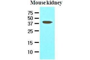 The extracts of mouse kidney (50 ug) were resolved by SDS-PAGE, transferred to nitrocellulose membrane and probed with anti-human PDCD12 (1:1000). (AVEN Antikörper  (AA 254-362))