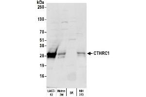 Western Blotting (WB) image for anti-Collagen Triple Helix Repeat Containing 1 (CTHRC1) (AA 193-243) antibody (ABIN7449188)