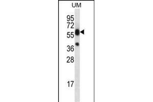 LI Antibody (C-term) (ABIN656461 and ABIN2845745) western blot analysis in uterus tumor cell line lysates (35 μg/lane). (LIPM Antikörper  (C-Term))