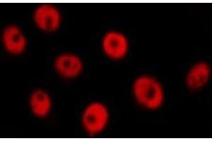 ABIN6277733 staining  Hela cells by IF/ICC. (RAD21 Antikörper  (C-Term))