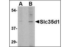 Western blot analysis of Slc35D1 in Daudi lysate with this product at (A) 1 and (B) 2 μg/ml. (SLC35D1 Antikörper  (C-Term))