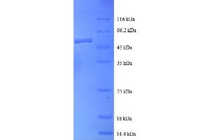 SDS-PAGE (SDS) image for RAB1A, Member RAS Oncogene Family (RAB1A) (AA 2-205) protein (GST tag) (ABIN5712049)