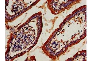 Immunocytochemistry analysis of human small intestine tissue using ABIN7171289 at dilution of 1:100 (TCRb Antikörper  (AA 22-115))