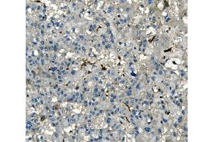 IHC analysis of AKR1D1 using anti-AKR1D1 antibody (ABIN7602741). (AKR1D1 Antikörper  (C-Term))