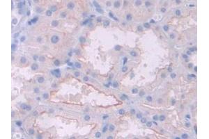 Immunohistochemistry (IHC) image for anti-Hemochromatosis Type 2 (Juvenile) (HFE2) (AA 234-416) antibody (ABIN1175334)