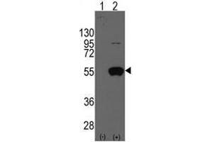 Image no. 1 for anti-Aldehyde Dehydrogenase 2 Family (Mitochondrial) (ALDH2) (N-Term) antibody (ABIN356917) (ALDH2 Antikörper  (N-Term))