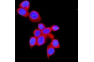 IF analysis of STUB1 using anti-STUB1 antibody (ABIN5693017).