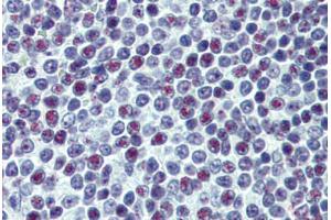 Human Spleen: Formalin-Fixed, Paraffin-Embedded (FFPE)