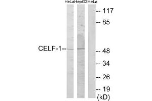 Western blot analysis of extracts from HeLa cells and HepG2 cells, using CELF-1 antibody. (CELF1 Antikörper  (Internal Region))
