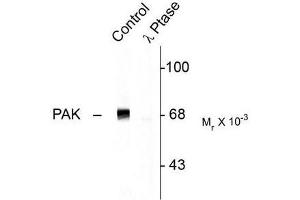 Image no. 1 for anti-P21-Activated Kinase 1 (PAK1) (pThr402) antibody (ABIN372696) (PAK1 Antikörper  (pThr402))