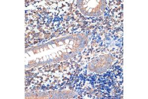Immunohistochemistry of paraffin-embedded human appendix using CRMP5/DPYSL5 Rabbit mAb (ABIN7266774) at dilution of 1:100 (40x lens).