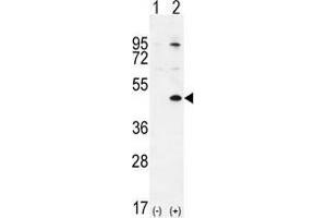 Western blot analysis of TGIF1 (arrow) using rabbit polyclonal TGIF1 Antibody (Center L223) .