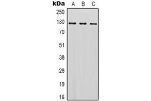 Western blot analysis of SREBP1 expression in Hela (A), Jurkat (B), NIH3T3 (C) whole cell lysates. (SREBF1 Antikörper)