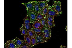 Immunofluorescence staining of CD71 in human HeLa cell line using anti-CD71 (; green). (Transferrin Receptor Antikörper  (PE))