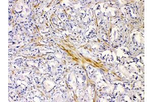 Immunohistochemistry (IHC) image for anti-Cholinergic Receptor, Nicotinic, alpha 5 (Neuronal) (CHRNA5) (AA 44-76), (N-Term) antibody (ABIN5518749)