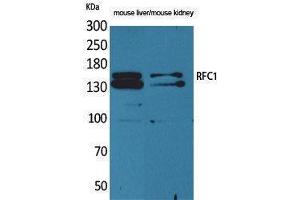 Western Blotting (WB) image for anti-Replication Factor C (Activator 1) 1, 145kDa (RFC1) (Internal Region) antibody (ABIN3178344) (RFC1 Antikörper  (Internal Region))