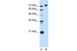 PTPRN antibody used at 0. (PTPRN Antikörper  (Middle Region))