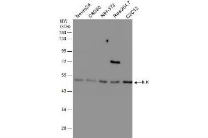 Western Blotting (WB) image for anti-Integrin-Linked Kinase (ILK) antibody (ABIN2854345)