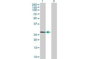 Western Blotting (WB) image for HES4 293T Cell Transient Overexpression Lysate(Denatured) (ABIN1337302)