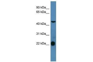 SSTR1 antibody used at 0.