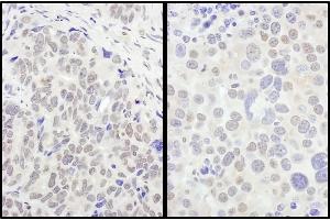 Immunohistochemistry (IHC) image for anti-Forkhead Box O3 (FOXO3) (C-Term) antibody (ABIN7454632)