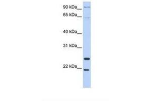 Image no. 1 for anti-Granzyme A (Granzyme 1, Cytotoxic T-Lymphocyte-Associated serine Esterase 3) (GZMA) (AA 110-159) antibody (ABIN6738997) (GZMA Antikörper  (AA 110-159))