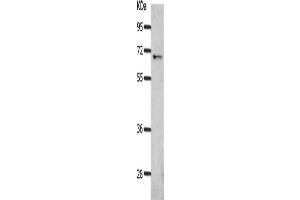 Gel: 10 % SDS-PAGE, Lysate: 40 μg, Lane: Mouse eyes tissue, Primary antibody: ABIN7189978(BEST1 Antibody) at dilution 1/300, Secondary antibody: Goat anti rabbit IgG at 1/8000 dilution, Exposure time: 2 minutes (Bestrophin 1 Antikörper)