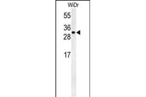 TM2D3 Antikörper  (N-Term)